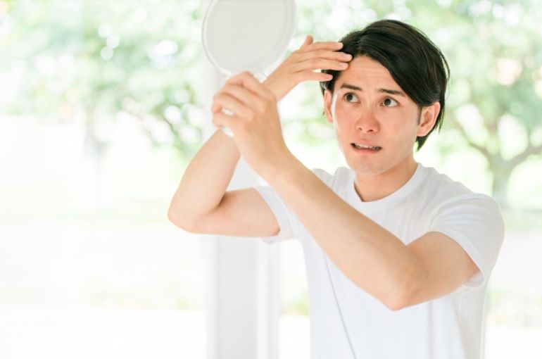 腸活　薄毛　AGA　AGA対策　ハゲ